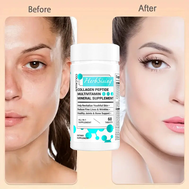 Collagen Peptides & Multivitamin for Women -- Anti- Aging. Skin, Hair, & Joint Support (60 Tablets)